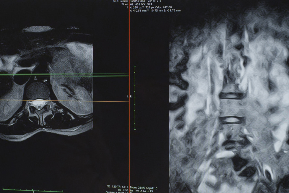 resonancia magentica